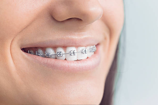 Best Dental Fillings (Composite and Amalgam)  in East Massapequa, NY
